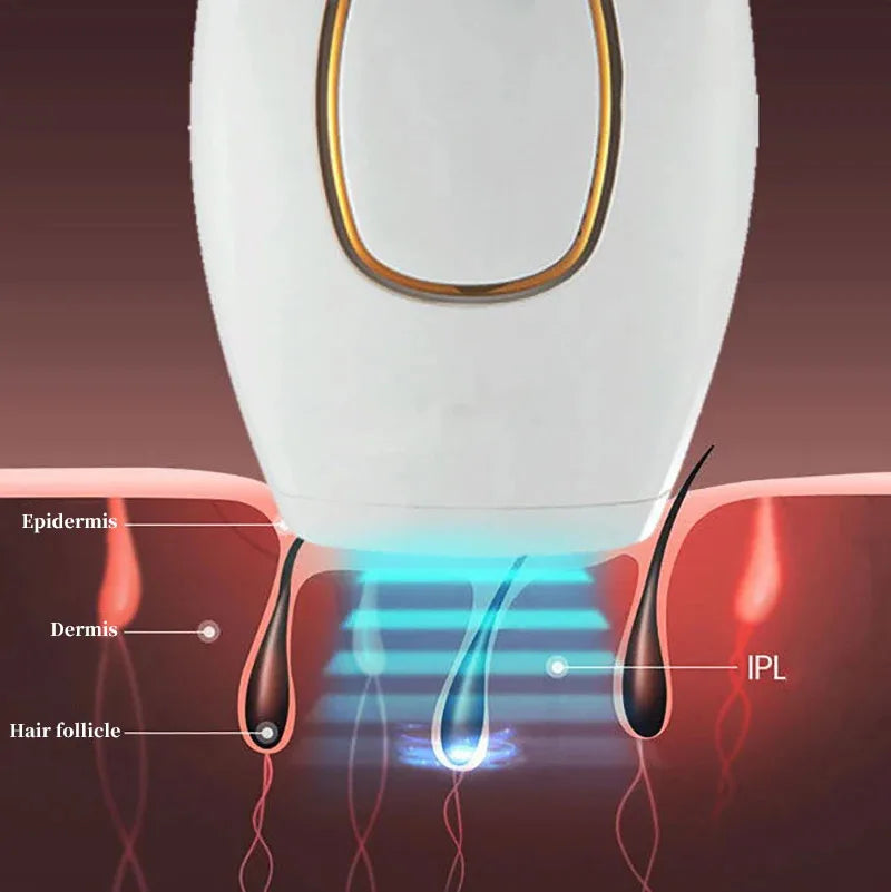 WIRELESS HAIR REMOVAL LASER